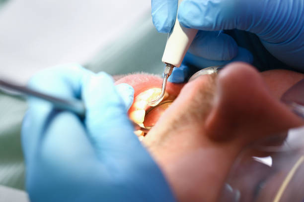 Best Emergency Treatment for Dental Infections or Abscesses in Elkland, PA